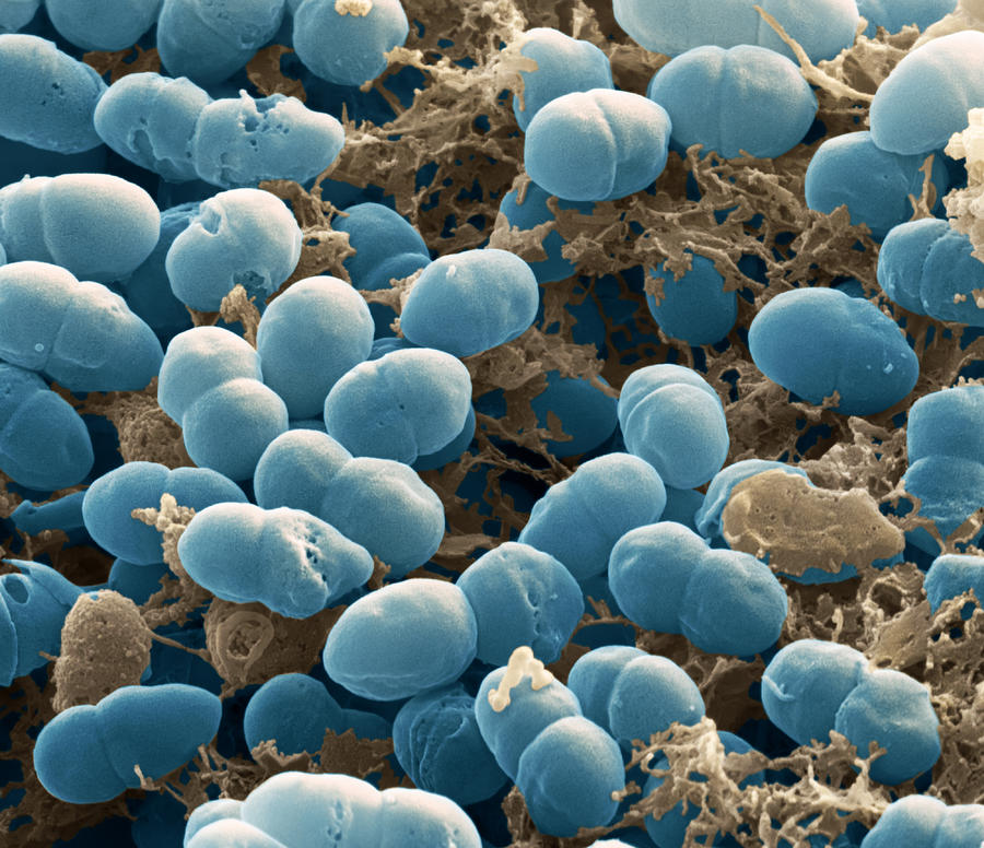 Staphylococcus Epidermidis Bacteria Sem Photograph By Meckes Ottawa