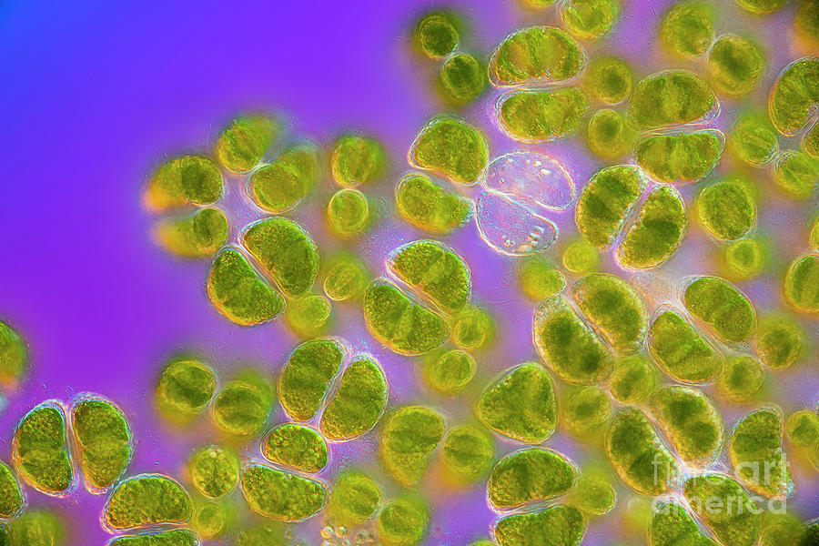 Staurastrum Muricatum Algae #1 Photograph by Frank Fox/science Photo Library