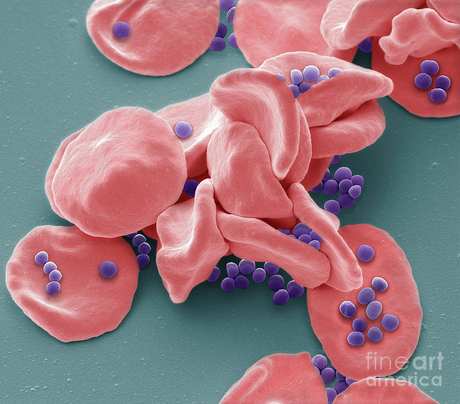 Strep A Infection #1 Photograph by Steve Gschmeissner/science Photo Library