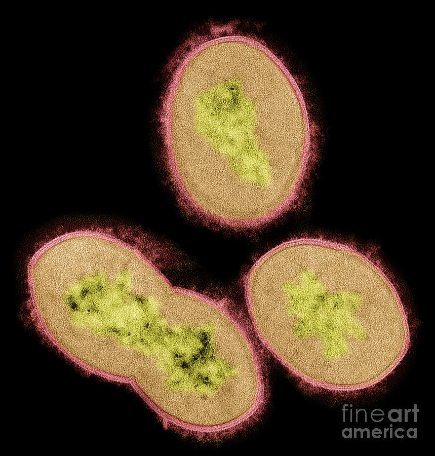 Streptococcus Bacteria #1 Photograph by Steve Gschmeissner/science Photo Library