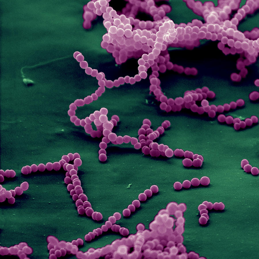 Streptococcus Pyogenes #1 Photograph by Oliver Meckes EYE OF SCIENCE