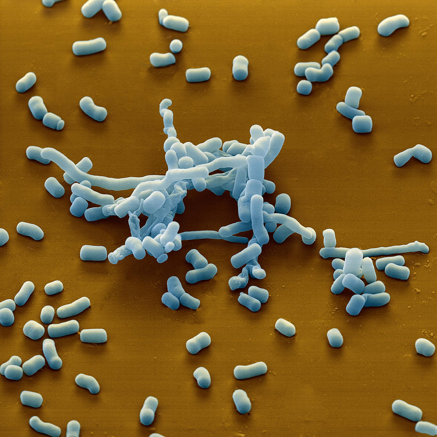 Streptomyces Sp., Sem #1 Photograph by Meckes/ottawa