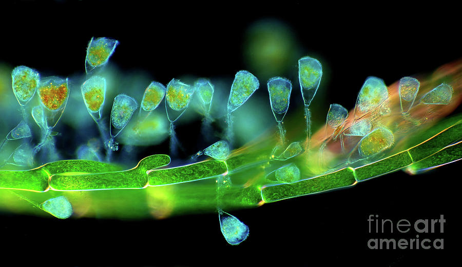 Suctorians On Cladophora Algae #1 Photograph by Marek Mis/science Photo Library
