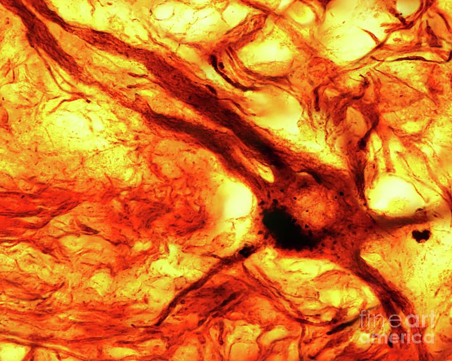 Sympathetic Neurons Photograph by Jose Calvo/science Photo Library