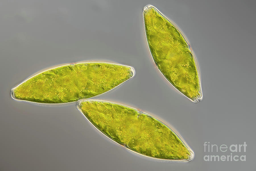 Tetmemorus Granulatus Algae #1 Photograph by Frank Fox/science Photo Library