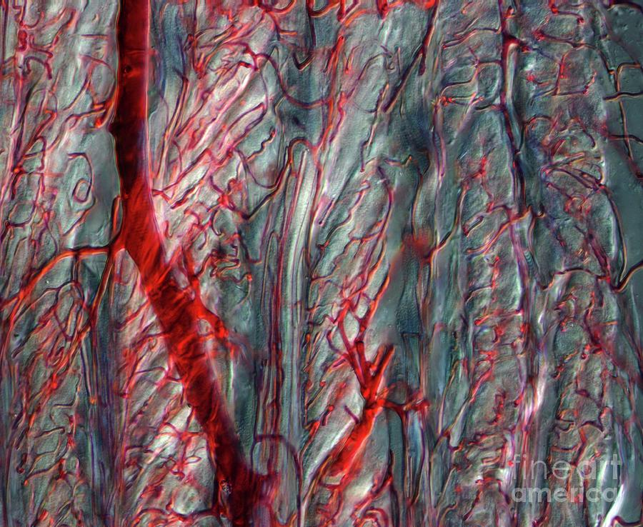 Tongue Blood Vessels Photograph by Ikelos Gmbh/dr. Christopher B ...