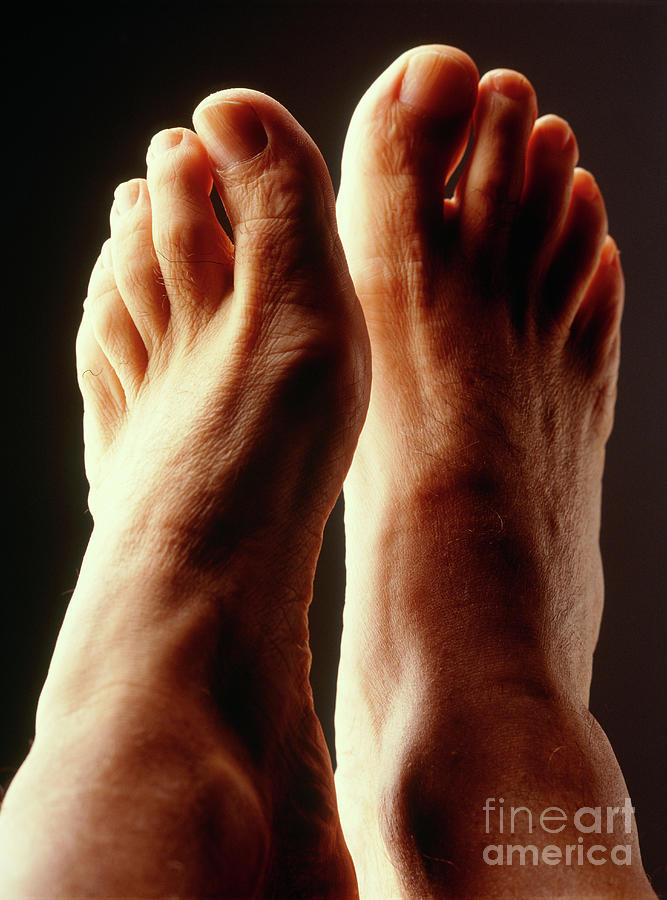 Top view of a man's healthy feet - Stock Image - P701/0128 - Science Photo  Library