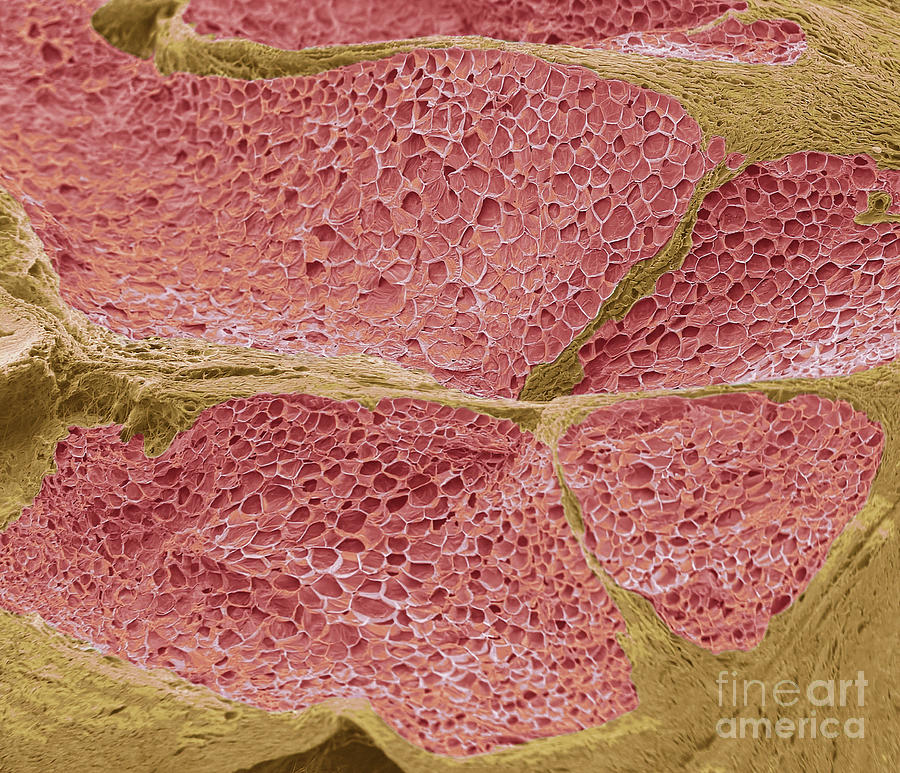 Tumour Adipose Tissue #1 Photograph by Steve Gschmeissner/science Photo Library