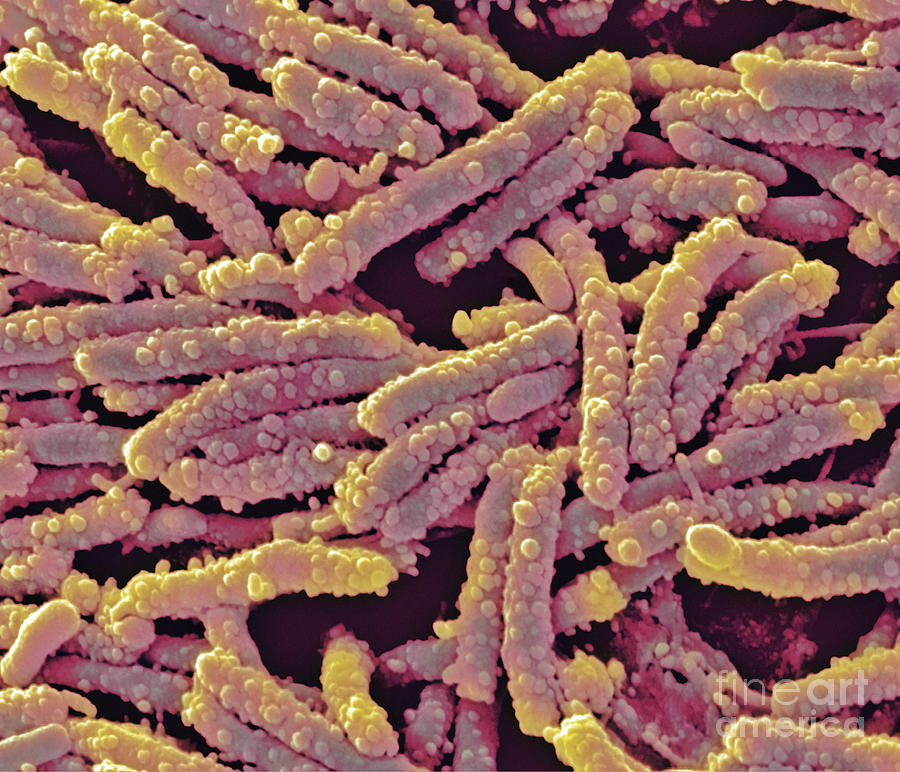 Unidentified Rod-shaped Bacteria #1 Photograph by Science Pictures Limited/science Photo Library