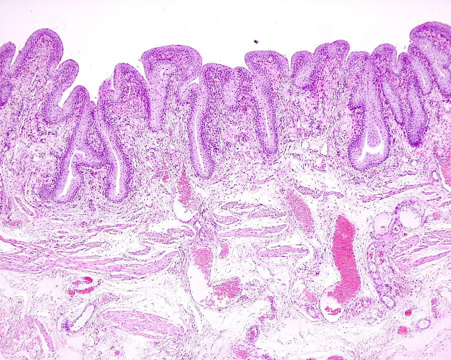 Urinary Bladder Photograph by Jose Calvo / Science Photo Library | Fine ...