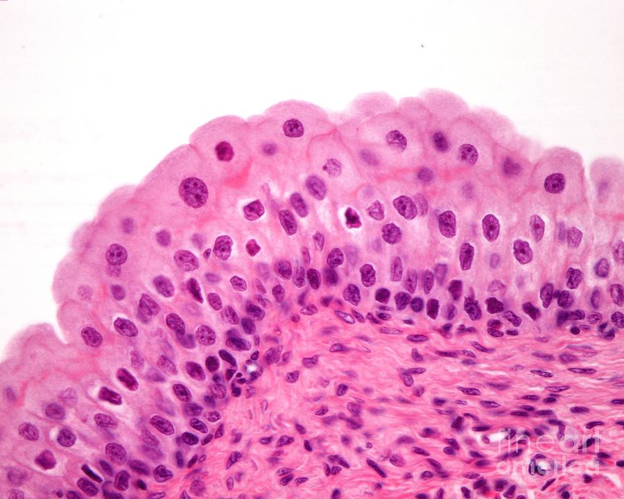 Urinary bladder with urothelium (transitional epithelium), connective  tissue and smooth muscle fibers. Photomicrograph X75 at 10 cm wide Stock  Photo - Alamy