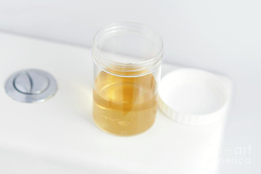 Как выглядит настоящая моча Urine Sample On Toilet #1 by Science Photo Library