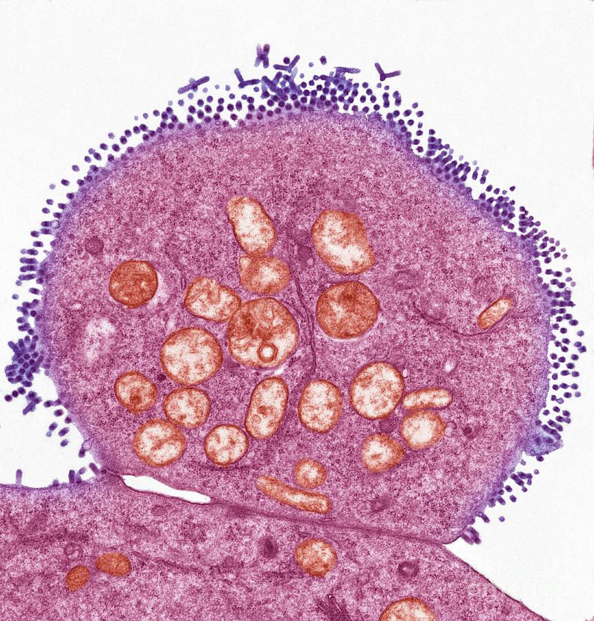 Vesicular Stomatitis Virus Photograph by Steve Gschmeissner/science