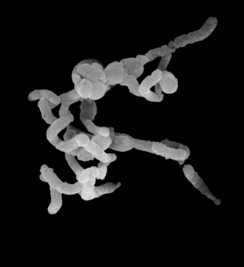 Vibrio Cholerae Sem #1 Photograph by Stem Jems