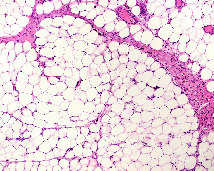 White Adipose Tissue #1 Photograph by Jose Calvo / Science Photo Library