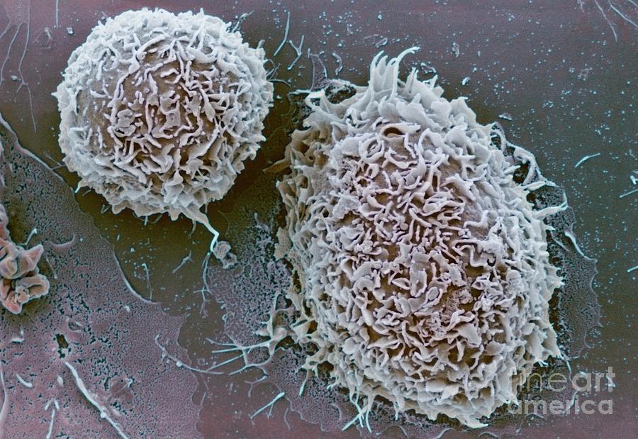 White Blood Cells #1 Photograph by A. Dowsett, National Infection Service/science Photo  Library