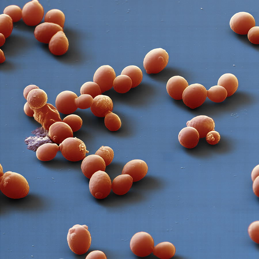 Yeast Cells, Sem #1 Photograph by Meckes/ottawa