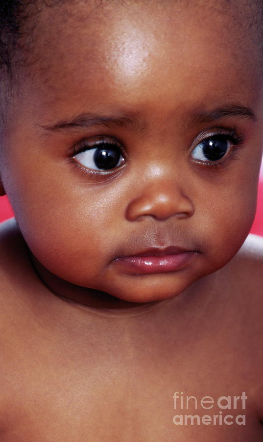 Baby Girl #10 Photograph by Paul Whitehill/science Photo Library