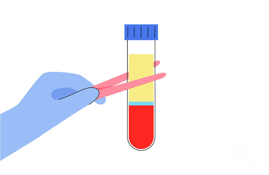 Prp Photograph - Blood Composition #10 by Pikovit / Science Photo Library