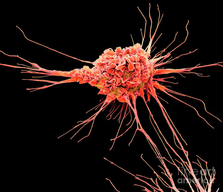 Dendritic Cell 10 Photograph By Steve Gschmeissnerscience Photo Library Fine Art America 