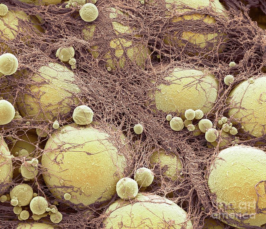 Fat Cells #10 Photograph by Steve Gschmeissner/science Photo Library