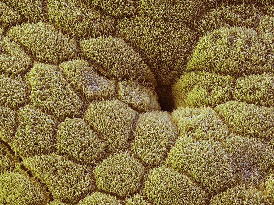 Gallbladder, Sem #10 Photograph by Eye Of Science