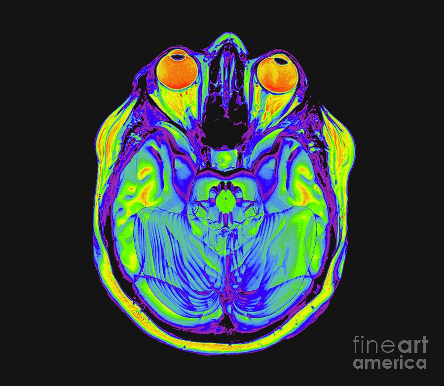 Human Eyes And Brain #10 Photograph by Zephyr/science Photo Library
