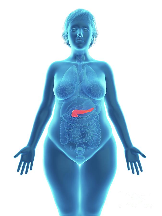 3d Photograph - Illustration Of An Obese Womans Pancreas by Sebastian Kaulitzki/science Photo Library 3d Photograph - Illustration Of An Obese Womans Pancreas by Sebastian Kaulitzki/science Photo Library