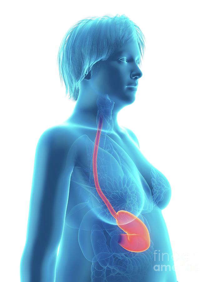 3d Photograph - Illustration Of An Obese Womans Stomach by Sebastian Kaulitzki/science Photo Library 3d Photograph - Illustration Of An Obese Womans Stomach by Sebastian Kaulitzki/science Photo Library