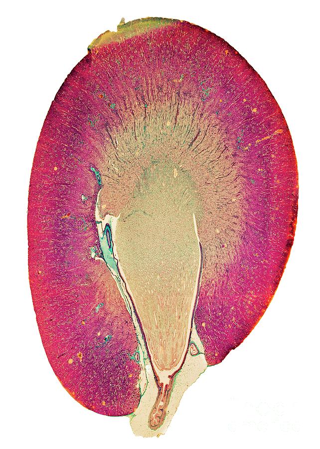 Kidney #10 Photograph by Dr Keith Wheeler/science Photo Library