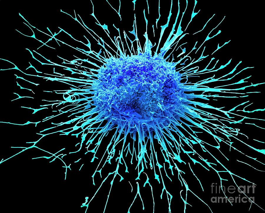 Lung Cancer Cell #10 Photograph by Steve Gschmeissner/science Photo Library