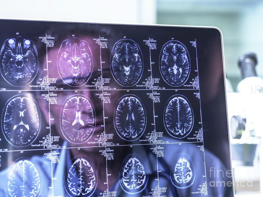Neurology Diagnosis #10 Photograph by Tek Image/science Photo Library