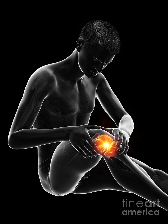 Painful Knee #10 Photograph by Sebastian Kaulitzki/science Photo Library