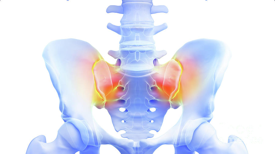 Painful Sacroiliac Joint Photograph by Sebastian Kaulitzki/science ...