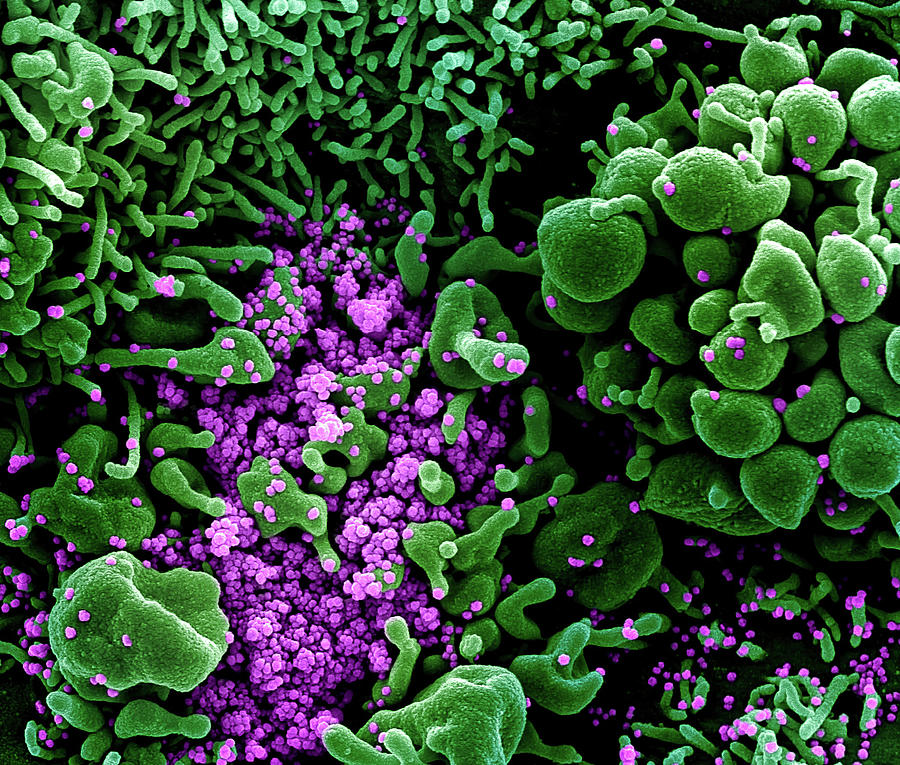 Sars-cov-2, Covid-19 Virus, Sem #10 Photograph by Science Source
