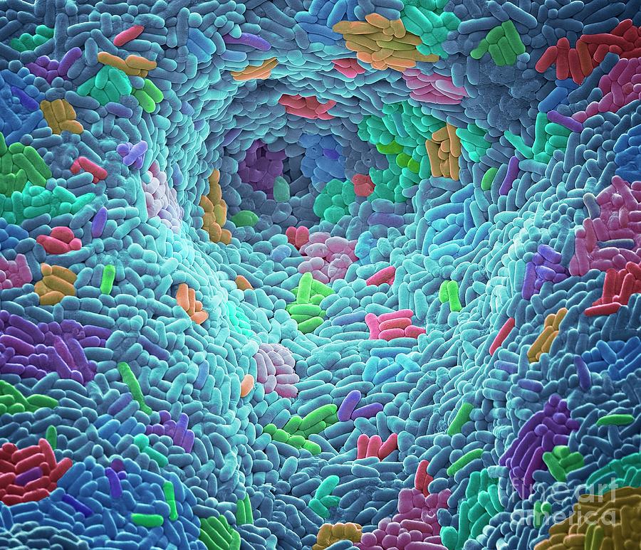 Skin Bacteria Photograph By Steve Gschmeissner Science Photo Library