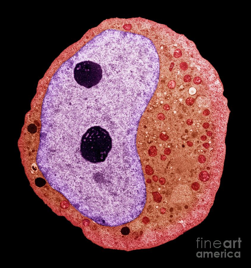 Testicular Cancer #10 Photograph by Steve Gschmeissner/science Photo Library