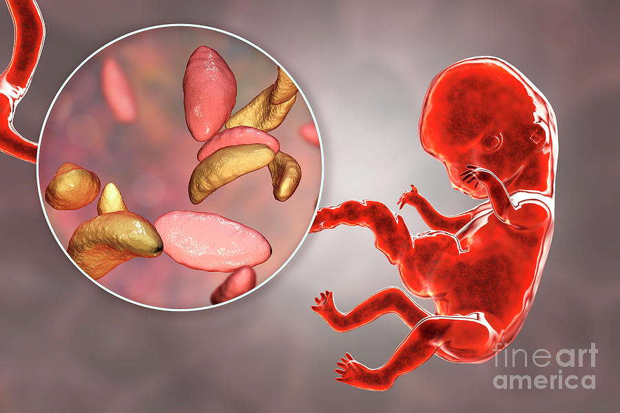 Transplacental Transmission Of Toxoplasmosis Photograph by Kateryna Kon