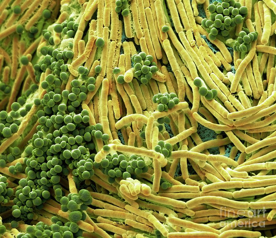 Bacteria Found On Mobile Phone Photograph By Steve Gschmeissner Science