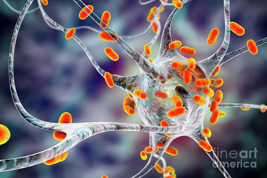 Bacterial Encephalitis #11 By Kateryna Kon/science Photo Library