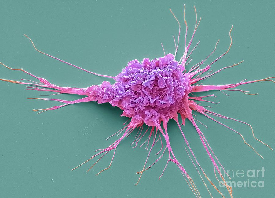 Dendritic Cell #11 Photograph by Steve Gschmeissner/science Photo Library