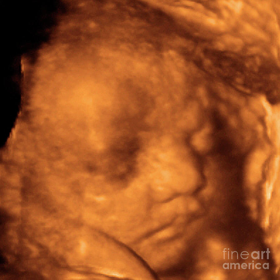 Foetus Face Photograph By Dr Najeeb Layyous Science Photo Library Pixels