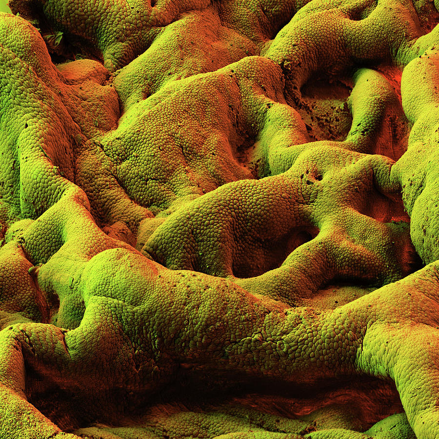 Gallbladder, Sem #11 Photograph by Eye Of Science