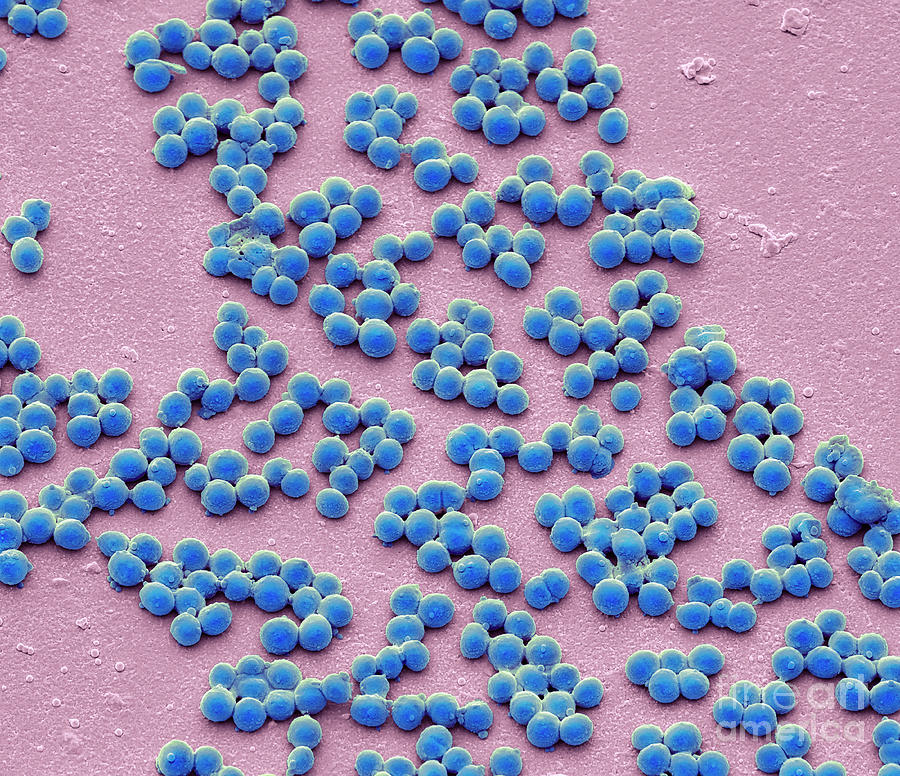 Group A Streptococcus Bacteria 11 By Steve Gschmeissnerscience Photo