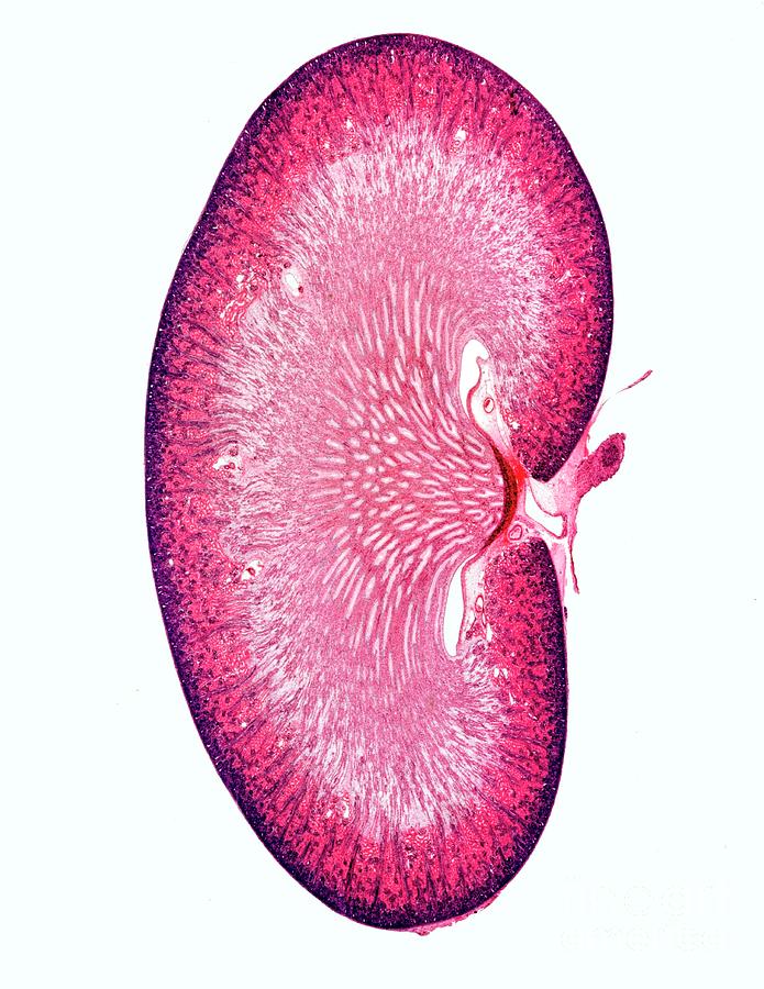 Kidney #11 Photograph by Dr Keith Wheeler/science Photo Library