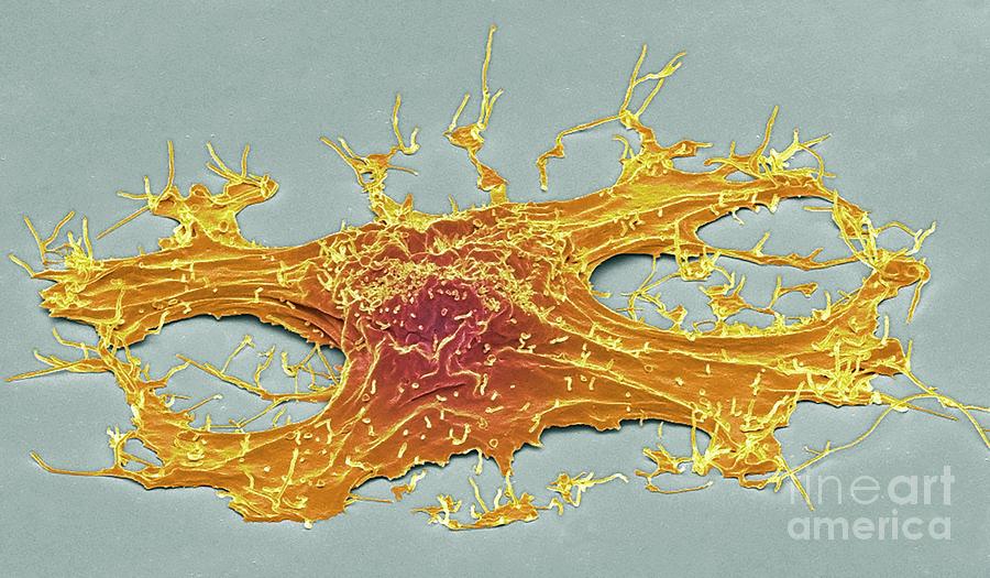 Lung Cancer Cell #11 Photograph by Steve Gschmeissner/science Photo Library