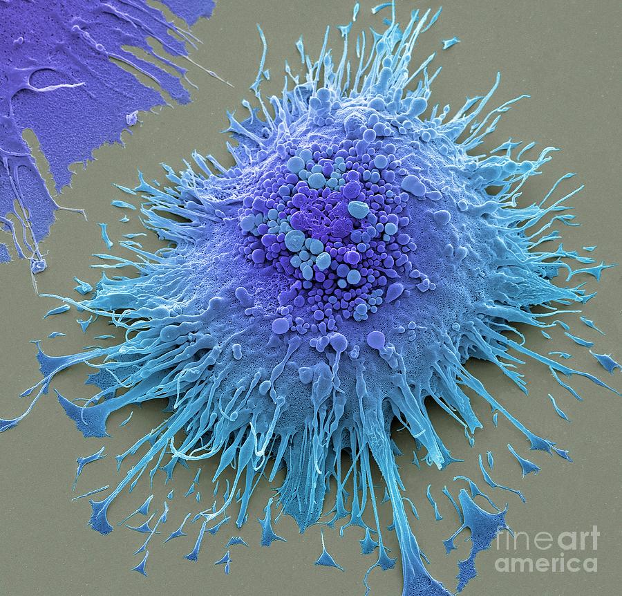 Macrophage Photograph By Steve Gschmeissner Science Photo Library Pixels