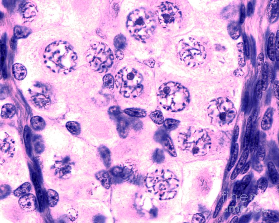 Biology Photograph - Meiosis In Fetal Ovary by Jose Calvo / Science Photo Library Biology Photograph - Meiosis In Fetal Ovary by Jose Calvo / Science Photo Library