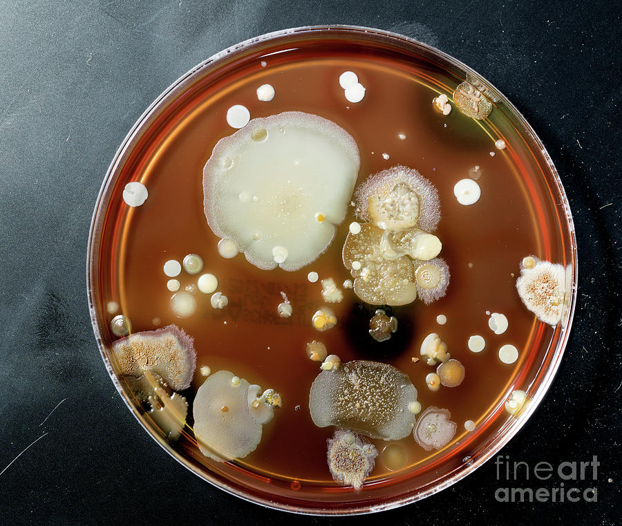 Growth Photograph - Microbes Growing On Agar Plate #11 by Wladimir Bulgar/science Photo Library