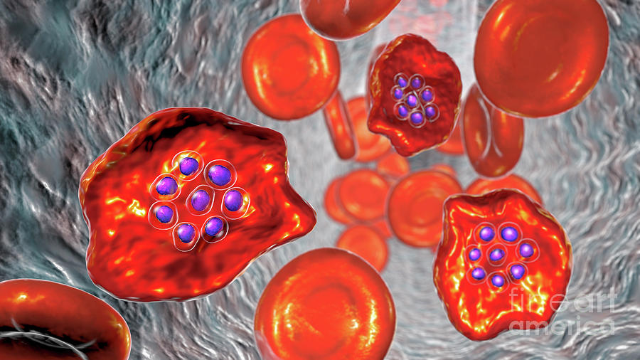Plasmodium Ovale Inside Red Blood Cell #11 Photograph by Kateryna Kon/science Photo Library